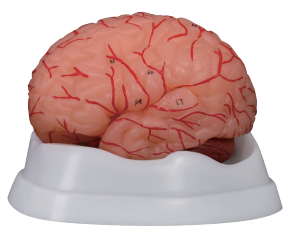 新型脑动脉模型9件