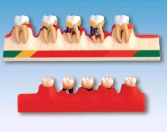 牙周病分类模型YR-L1010